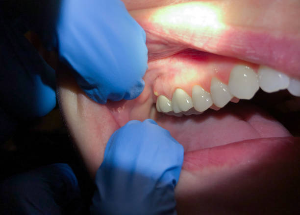 Best Urgent Care for Lost Fillings or Crowns in Cool Valley, MO