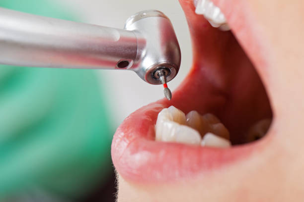 Best Emergency Treatment for Dental Infections or Abscesses in Cool Valley, MO